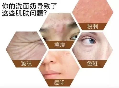 难怪我们每天用着上千元的护肤品精心护肤,可皮肤问题还是层出不穷!