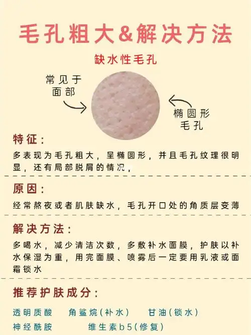 毛孔粗大怎么办71分清毛孔类型73正确护理