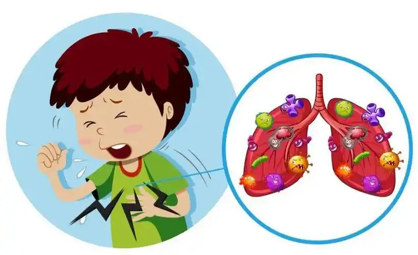近期警惕小儿肺炎支原体肺炎_孩子_支气管_症状
