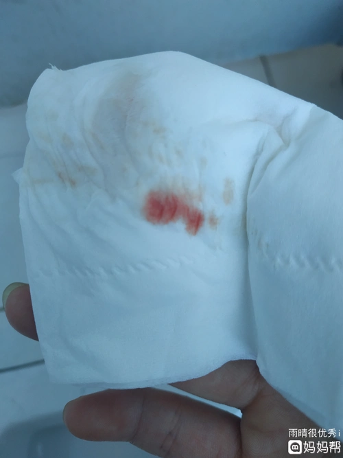 怀孕第一月下面少量咖啡色血(内裤上有棕褐色的血但没来月经)