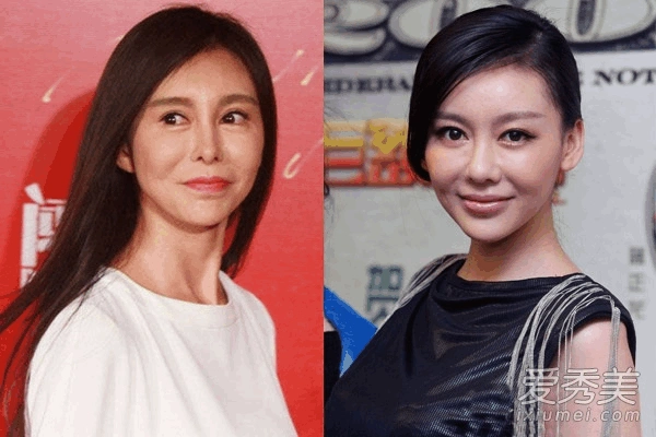 巩新亮郑爽萧蔷 10位整容失败女星