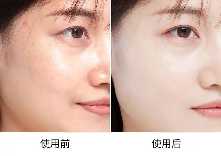 (使用前后的脸部对比:更白皙,面部油脂减少)洗后肌肤水润不紧绷,比较