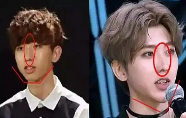 蔡徐坤成名前照片被曝在韩国双膝下跪太卑微整容前吓死个人