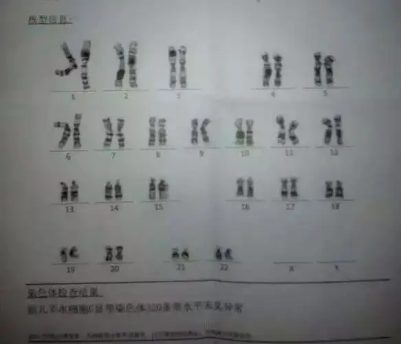 怀孕50天超声看孕囊能看出男女医生这样说