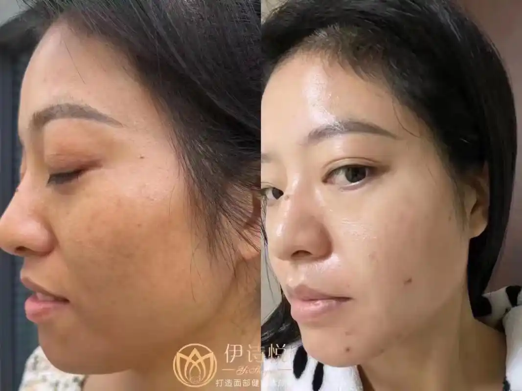 问题性皮肤管理 #告别肌肤问题  如果你有脸上有斑斑点点  - 抖音