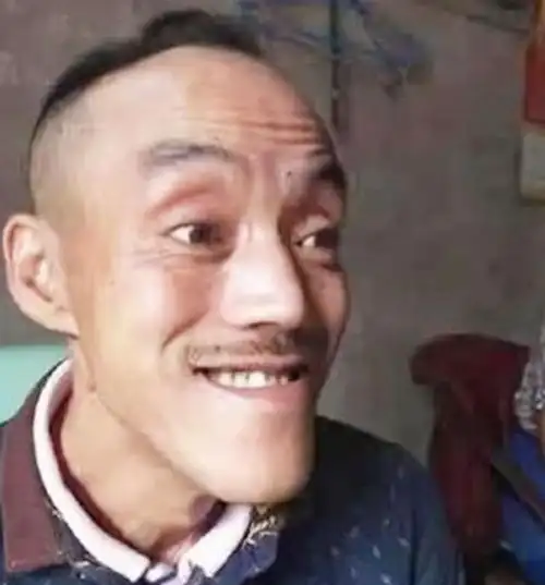 回顾靠"光头强"走红,娶网红开豪车,后媳妇跑路,开摩的讨生活