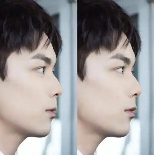 对于鼻型不甚完美的人来说,侧脸往往最能暴露缺陷,而对吴磊来说也不