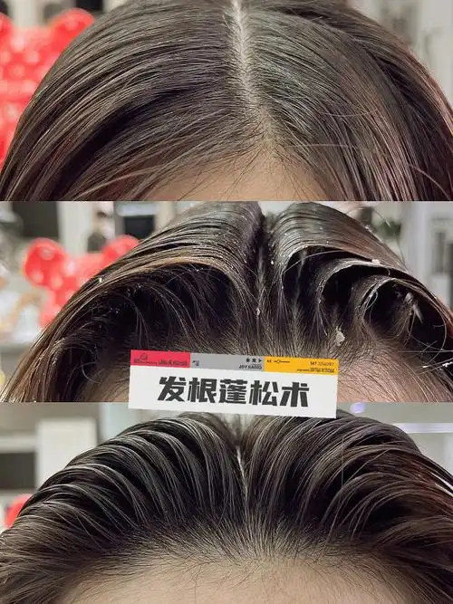 头发塌怎么让头顶蓬松头发怎么弄