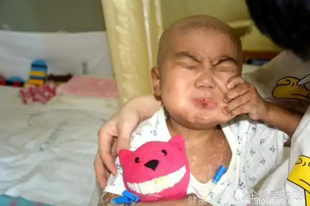 辽宁男童身患白血病 手握面包却张不开嘴