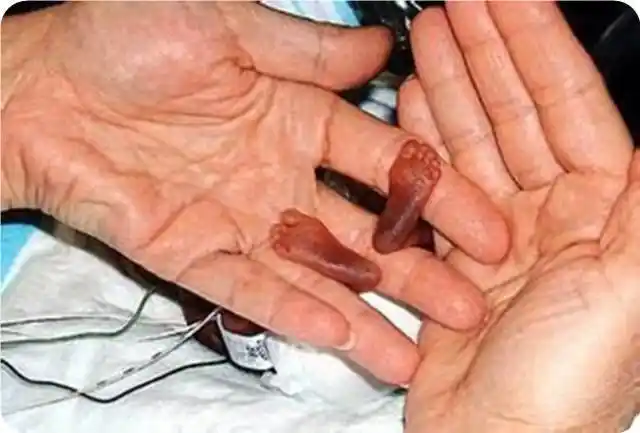 堕胎,不论对女性还是胎儿来说,都极度残忍!