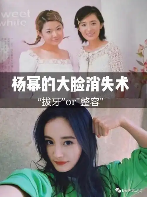 杨幂逆天改命是靠整容还是拔牙将大方脸变成小v脸的