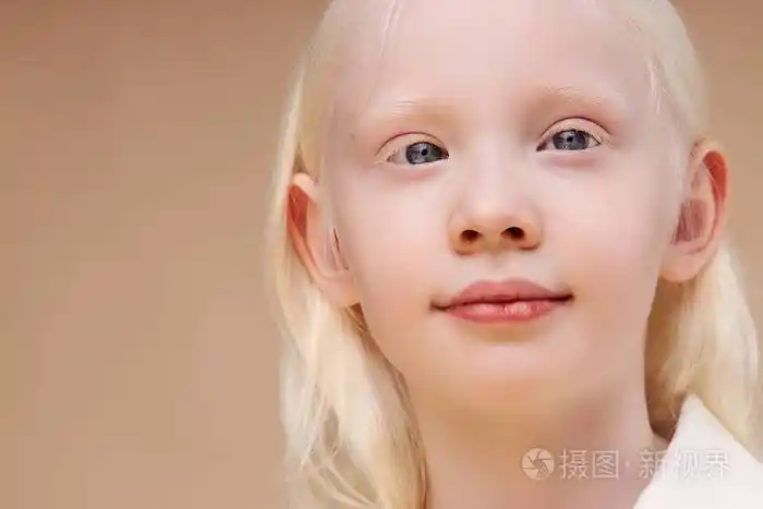 漂亮的金发白化病孩子与世隔绝