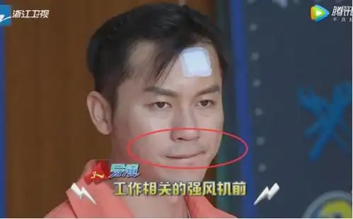《奔跑吧》李晨的鬓角和胡子的留青痕迹都超有男人味!