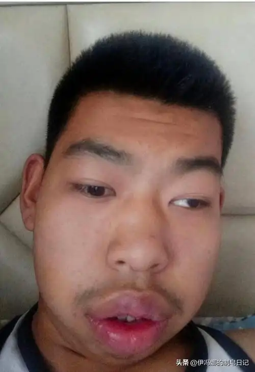 一定不要再侧躺玩手机了!网友:侧躺玩手机后,眼睛差点瞎了