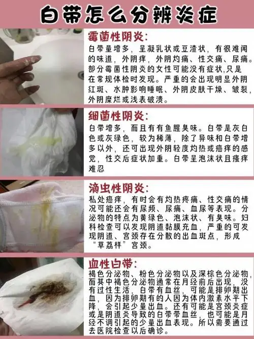 妇科炎症自测表(妇科炎症自测表!你对照了吗?
