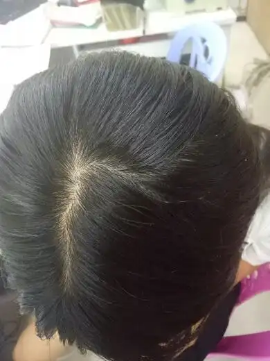 头皮颜色正常吗