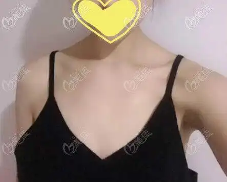 c罩杯是指上下胸围之差(乳头与乳房底部之差)15cm左右的女性罩杯.