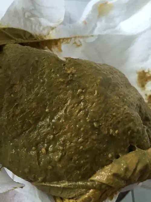 急……怕恶心的不要点开,宝宝大便色