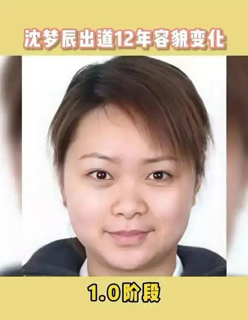 沈梦辰出道至今变化史,堪称换头术,这才叫教科书级整容!