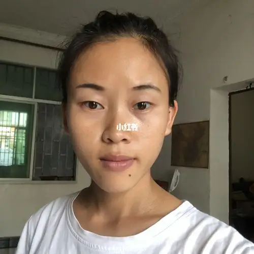 28岁好多人以为我35了_皮肤黄_疫情_减肥_减肥其他