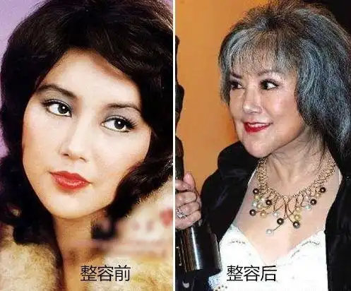 盘点整容失败的女星:金喜善假体掉下来,而她半张脸彻底毁掉了!