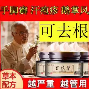 手癣膏真菌感染水泡脱皮湿疹止痒药膏干裂去根鹅掌风手脚癣汗疱疹