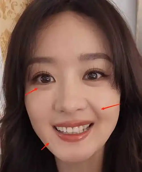 点赞量破440万!赵丽颖素颜照引发热议,治好了我的容貌焦虑