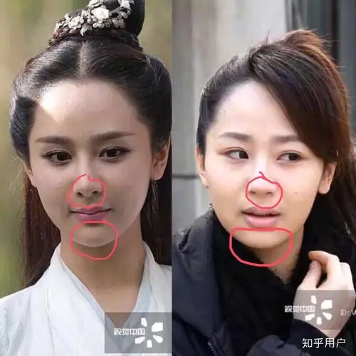 杨紫有没有整容?