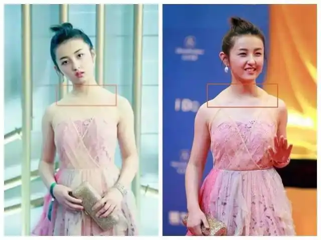 宅家吃的虎背熊腰?不,其实是你低头玩手机造成的斜方肌发达