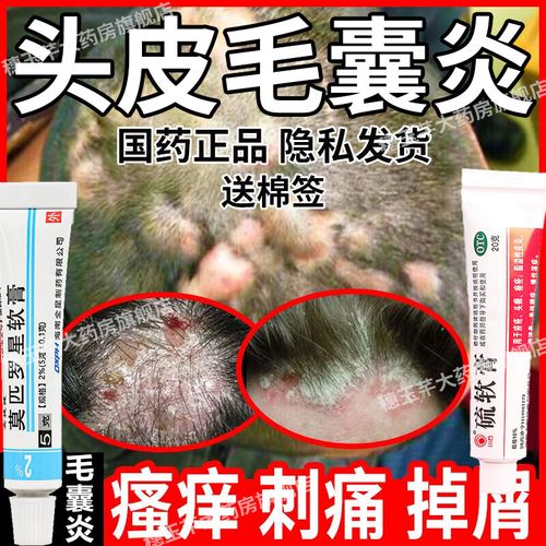 性皮炎药真菌感染皮肤用药毛囊炎头皮红疙瘩成人外用杀菌止痒祛痘膏 1