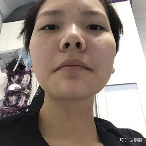 鼻孔大是什么感觉