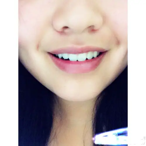 这种牙算虎牙吗?