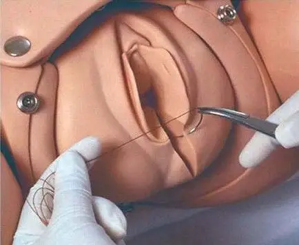 妇产科分娩模拟真人教具(组图)