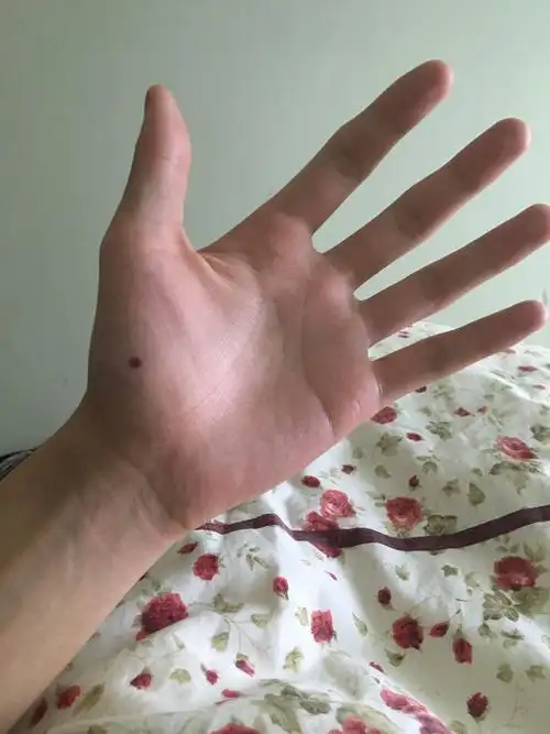 左手这个痣好不好以及我的手相怎么样