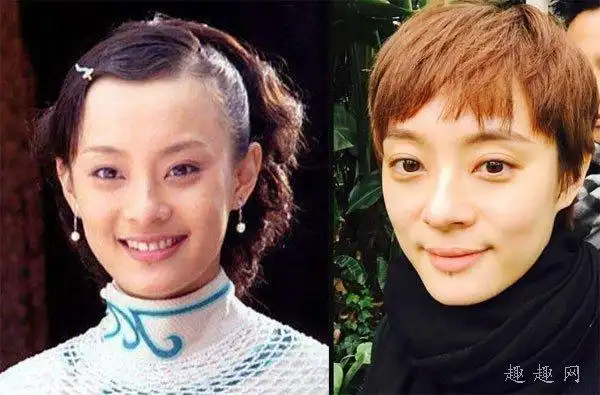 孙俪的眼睛怎么了那么凸呢(孙俪容貌变了)