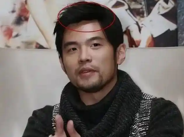 周杰伦的头发看上去并不稀疏,不过有些照片意外暴露了他戴假发片的