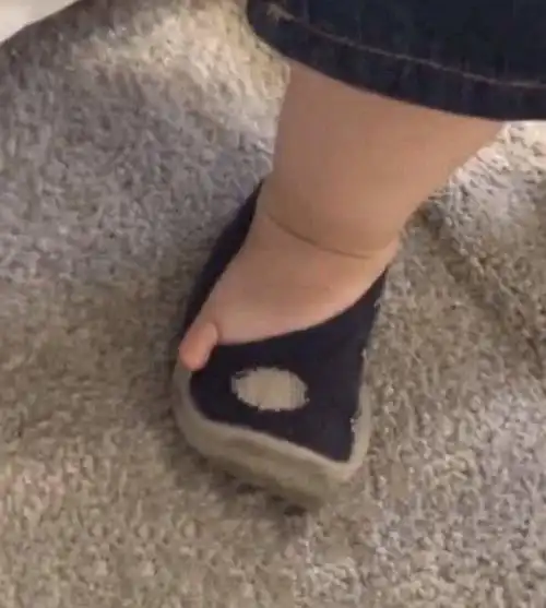 露出小脚趾表情包