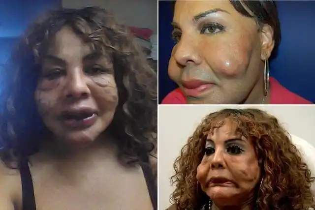 7大最可怕的失败整容整体假医生害人啊