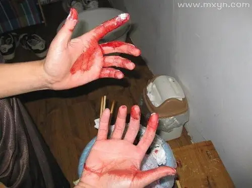 梦见自己手流血