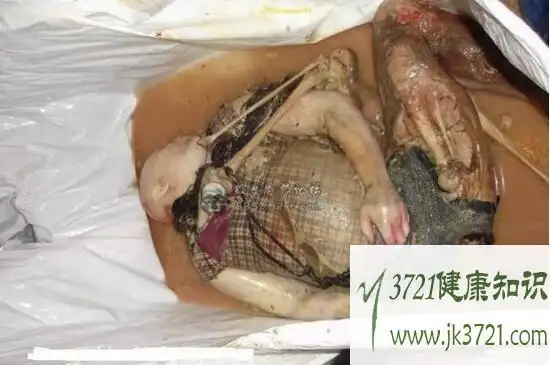 少女浴室20天生前照片浴室少女生前貌美死后惨不忍睹