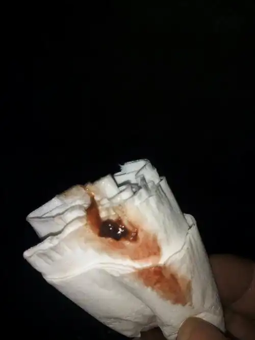 白带有血,怎么回事?