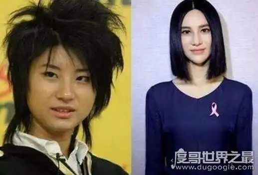 尚雯婕整容前后照片对比,换头术后遗症效果惊悚_秀站