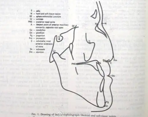 高难度鼻整形之binder综合征修复