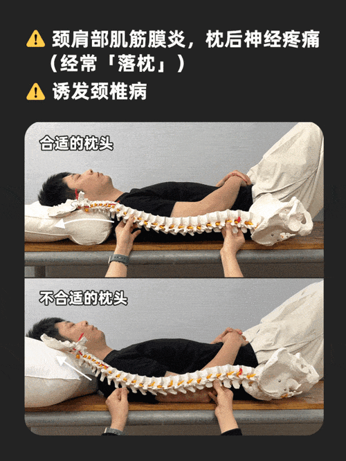 脖子前倾,驼背都可能是因为长期睡高枕头.有可能们我注关/字蓝击点