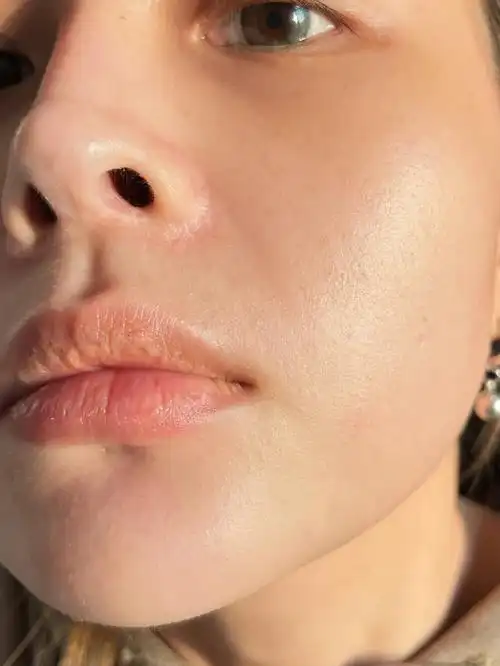 皮肤修复的第52天