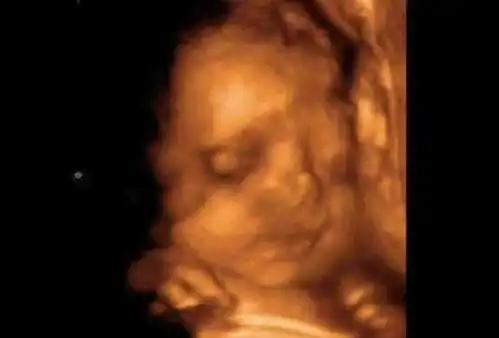 女子怀孕6个月被确诊胎儿畸形,医生说出原因后,孕妈肠子都悔青