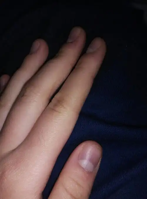 指甲最近变紫是不是有问题.