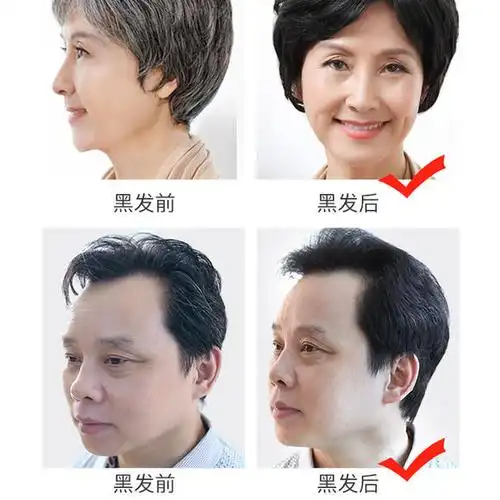 【5分钟告别白发】韩国黑发乳 快速黑发不伤发 植物无味无刺激 白发