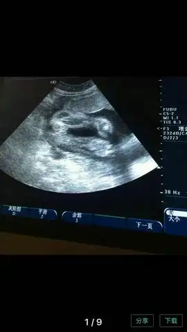 给你看个图你就明白了…放大看两腿之间有三个点,三条白线,男宝是没有