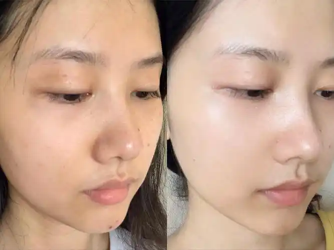 黄皮肤怎么有效美白